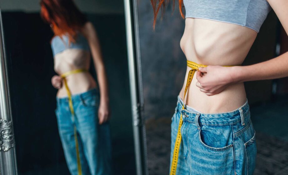 anoressia nervosa studio italiano svela chi risponde meglio alla terapia intensiva CBT-E