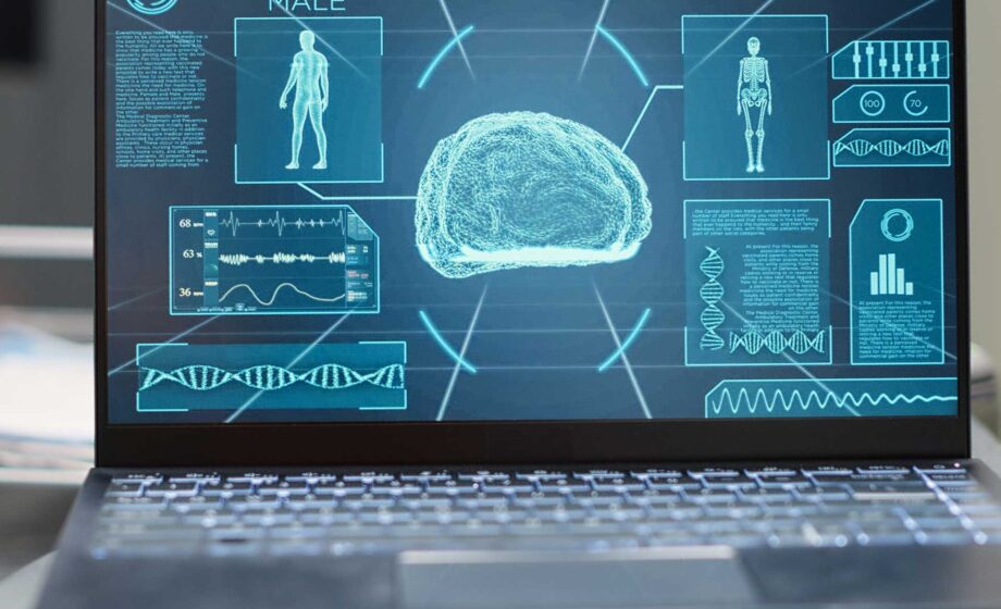 Foto di un cervello che rappresenta l'intelligenza artificiale in sanità