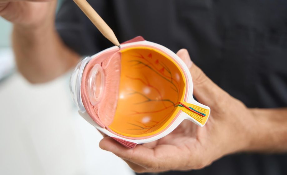 Un modellino di occhio umano mentre una matita indica la parte affetta da congiuntivite d'estate