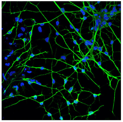Neuroni umani al microscopio